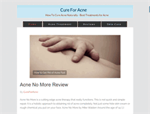 Tablet Screenshot of cure-for-acne.net